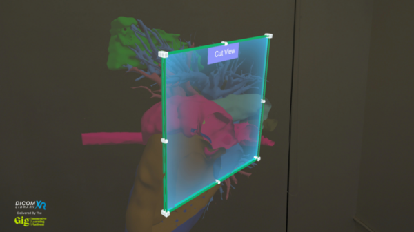 GigXR和DICOM Director宣布推出3D医学图像学习平台