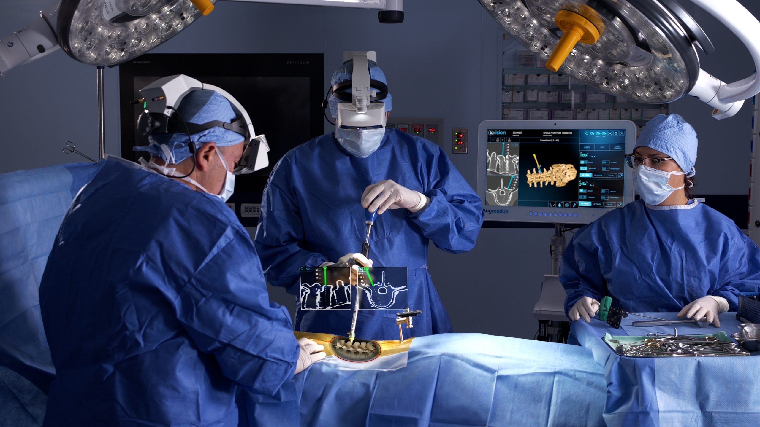 超4000个案例，这家公司成功将AR眼镜用于脊柱手术